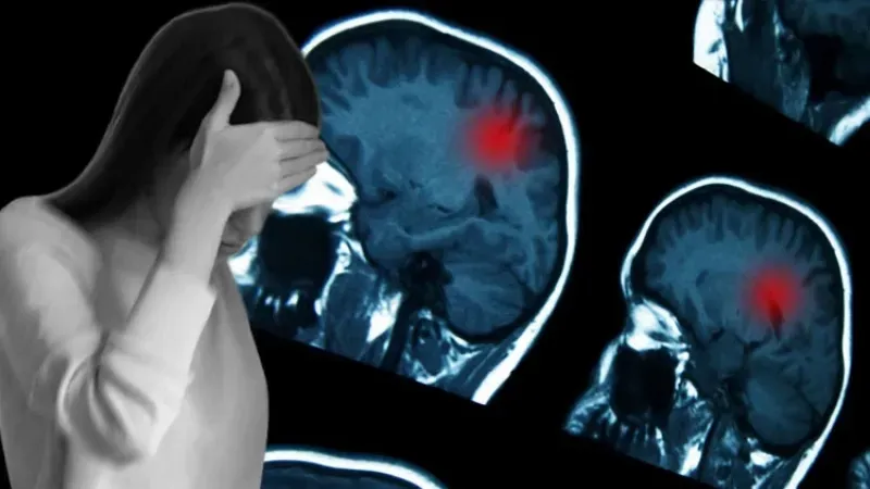 Migren dediler, birkaç hafta ömrü kaldığı ortaya çıktı! 